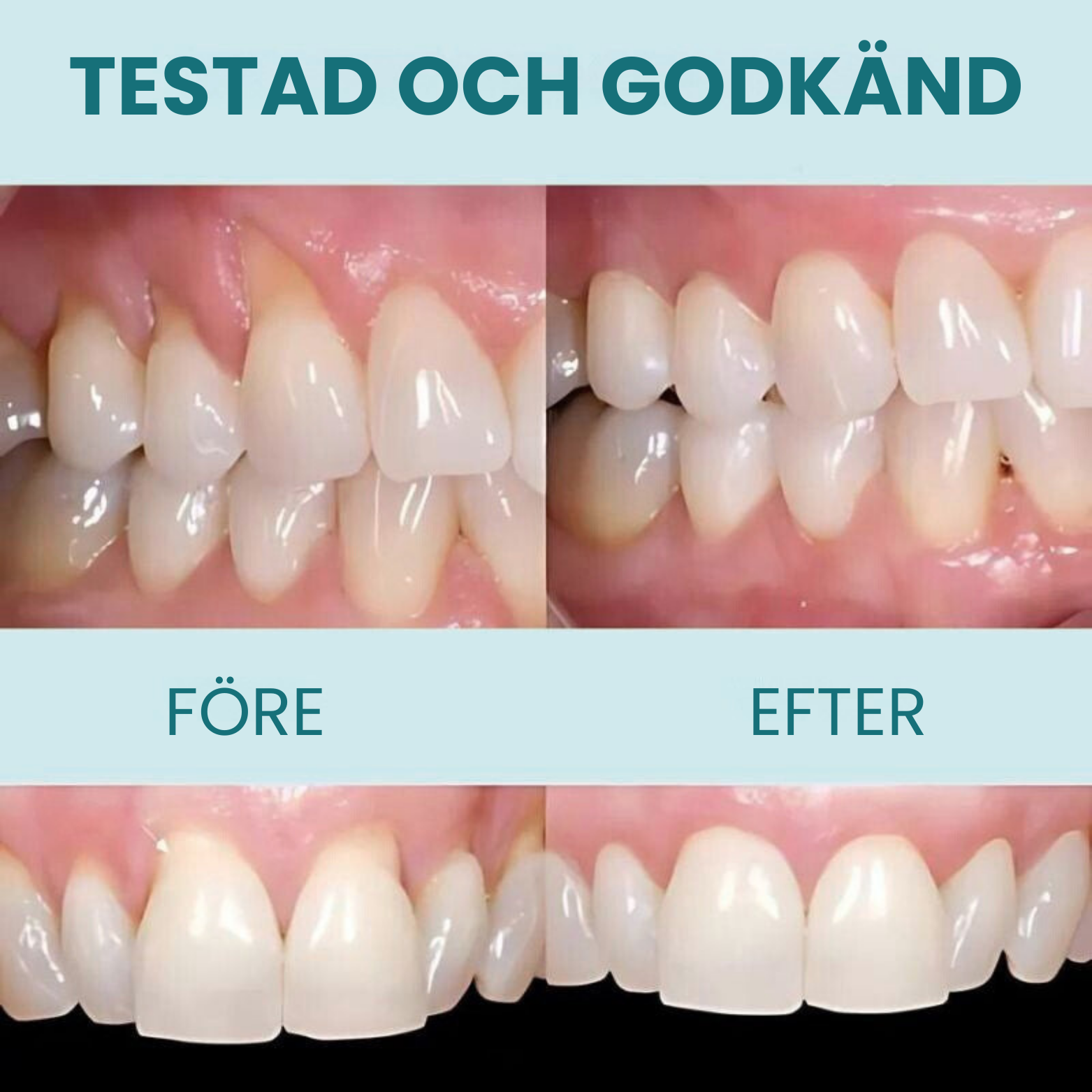 GumRegen™ Tandkötts-droppar