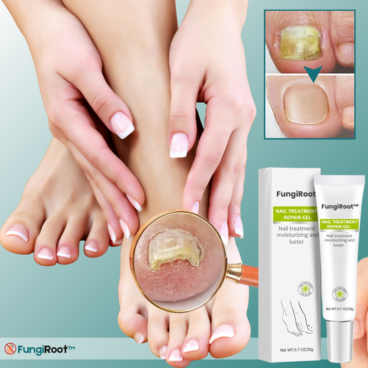 FungiRoot™ Nagelreparerande behandlingsgel