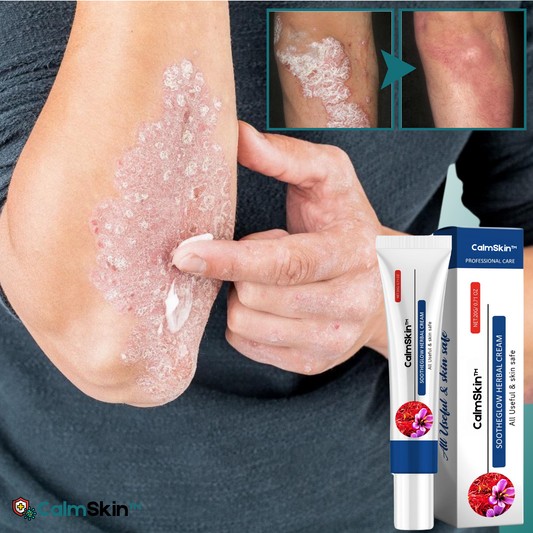 CalmSkin™ Avancerad Växtbaserad Läkningskräm