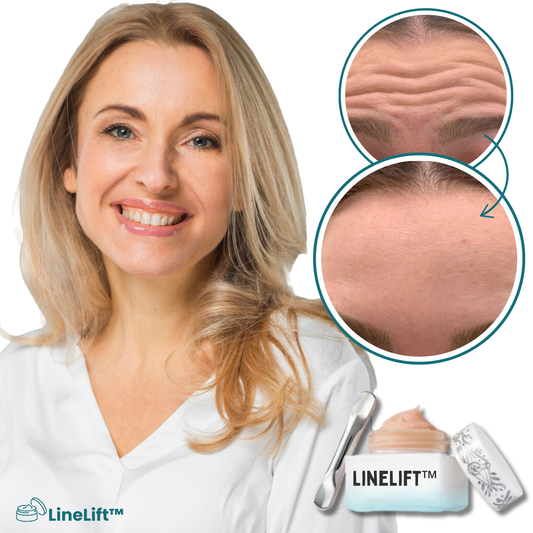 LineLift™ Rynk Corrector