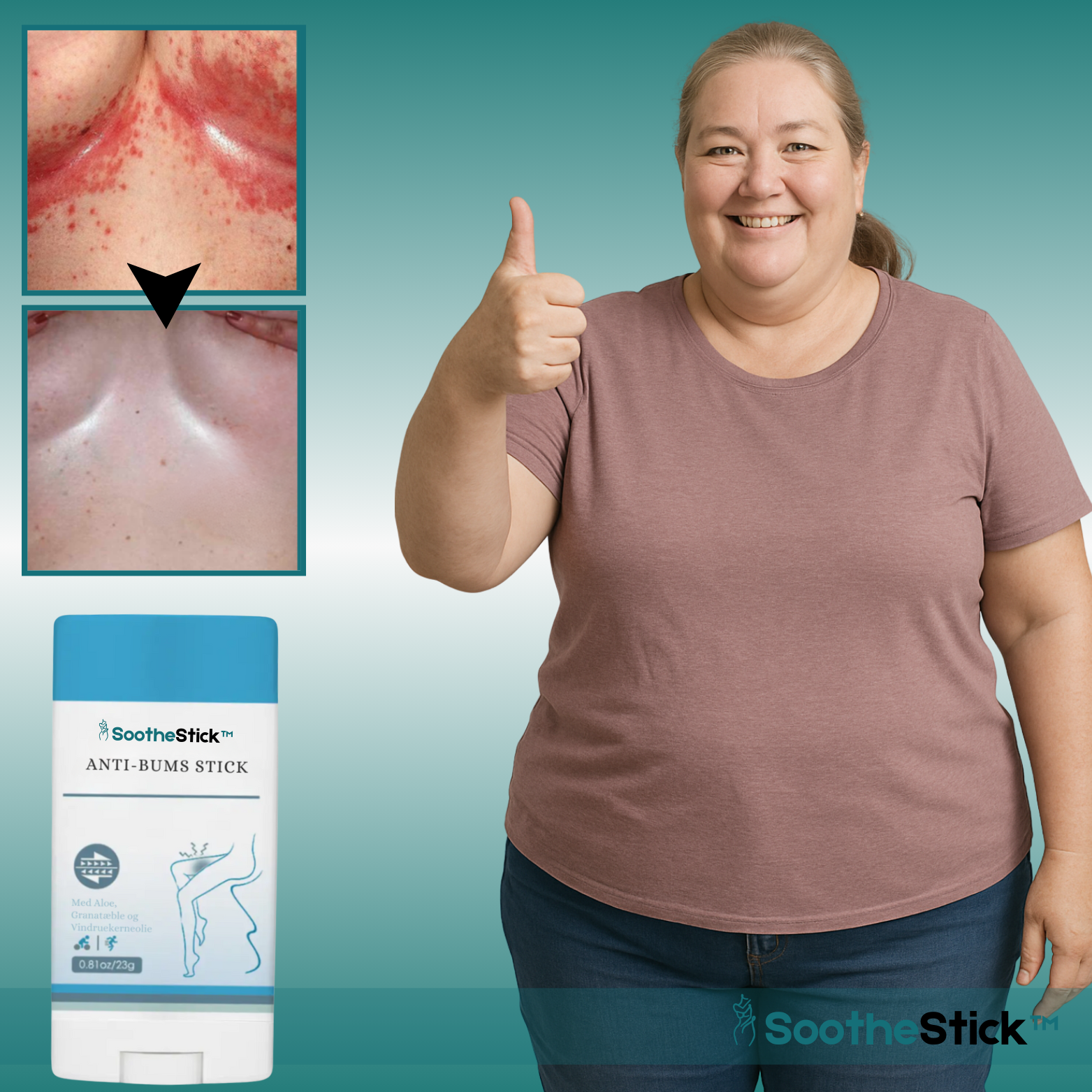 SootheStick™ Omedelbar Hudlindrings-Stick