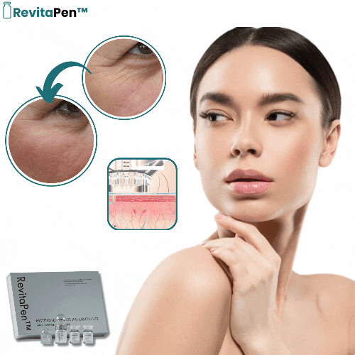 RevitaPen™ Mikroinfusionspenna