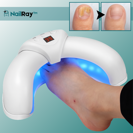 NailRay™ Laser Nagelbehandlingsenhet