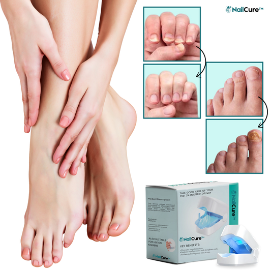 NailCure™ Anti-Svamp Laserapparat