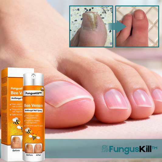 FungusKill™ Antifungal Nagelspray
