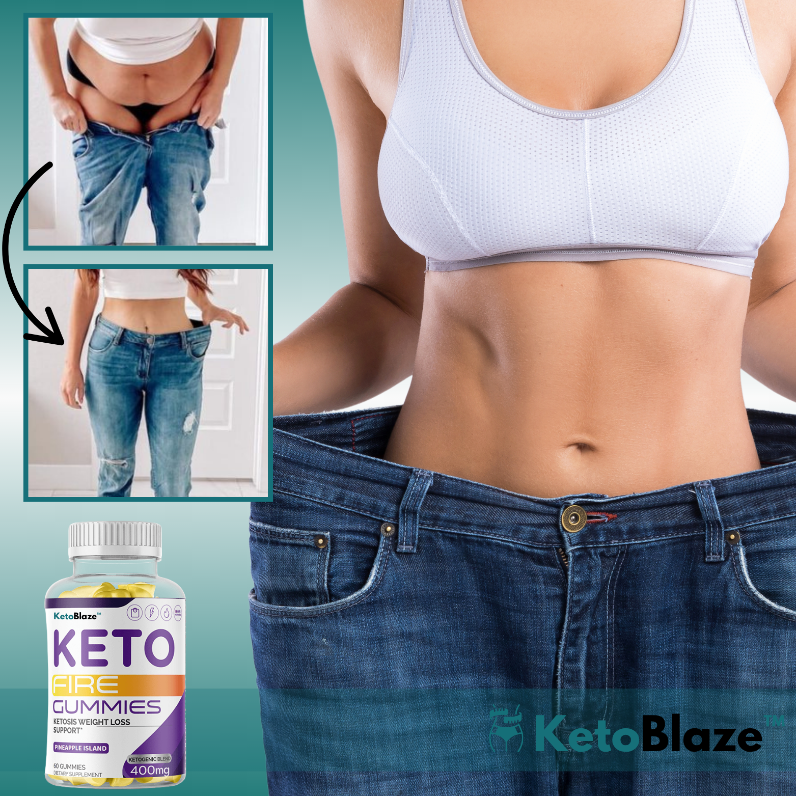 KetoBlaze™ Fettförbrännande Keto-gummies