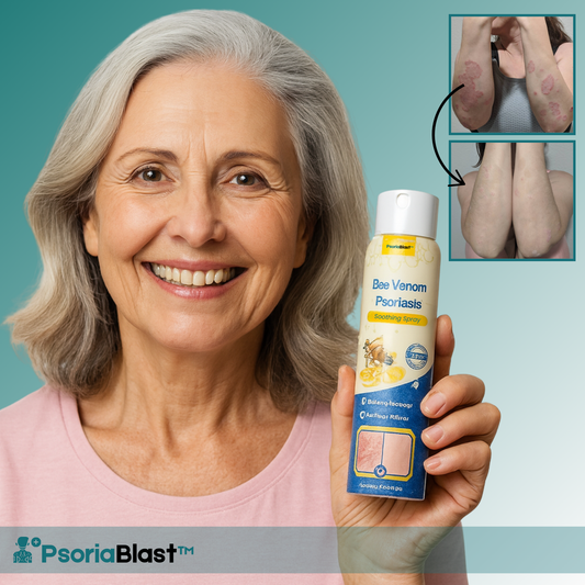 PsoriaBlast™ Bee Venom Psoriasis Spray
