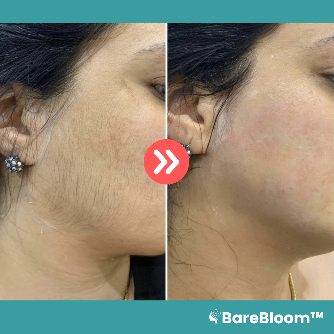 BareBloom™ Hormonell Hårborttagningskräm