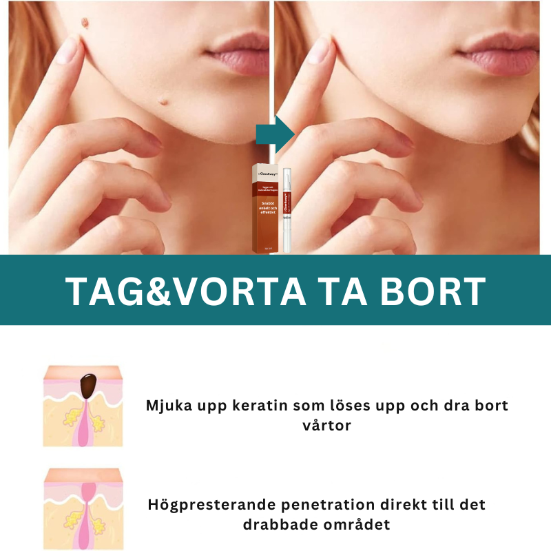 ClearAway™ Taggar och mullvadsborttagare