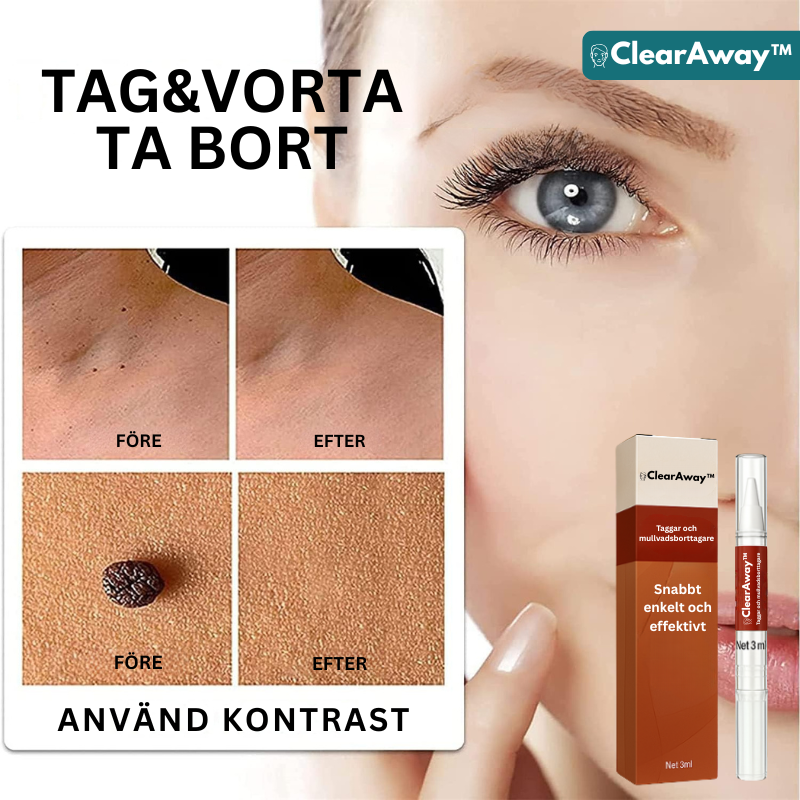 ClearAway™ Taggar och mullvadsborttagare