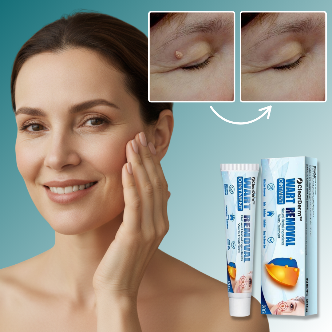 ClearDerm™ Vårtkkräm