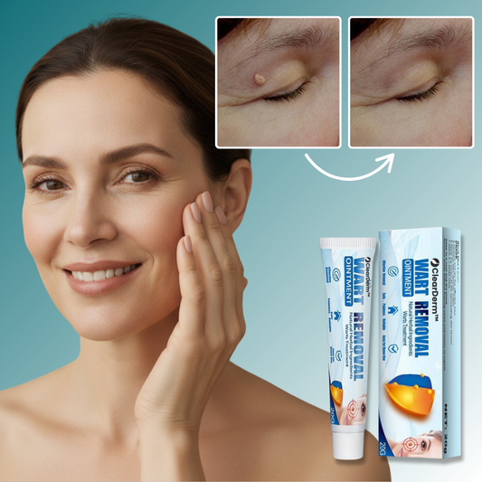 ClearDerm™ Vårtkkräm