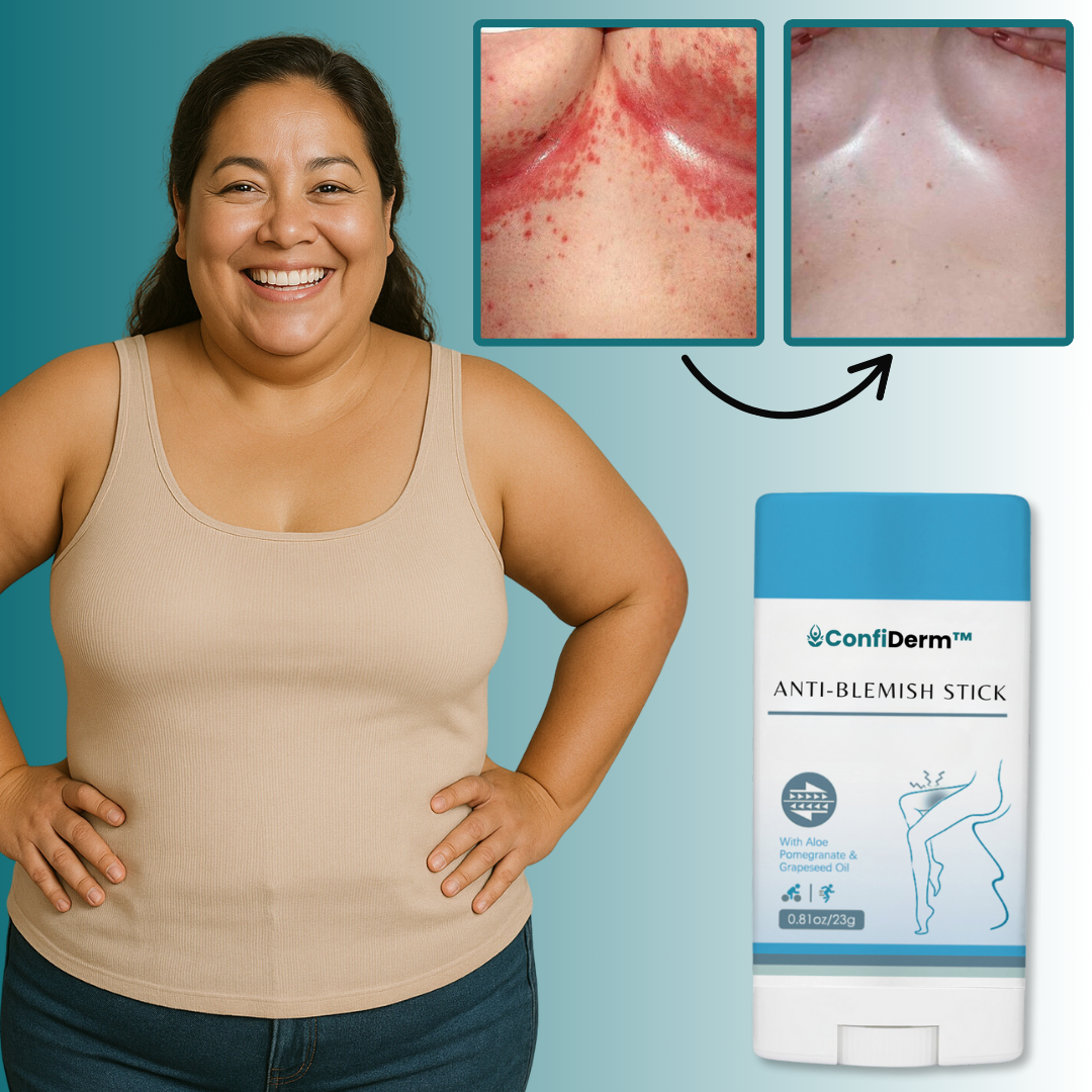 ConfiDerm™  Anti-Finne-Stick