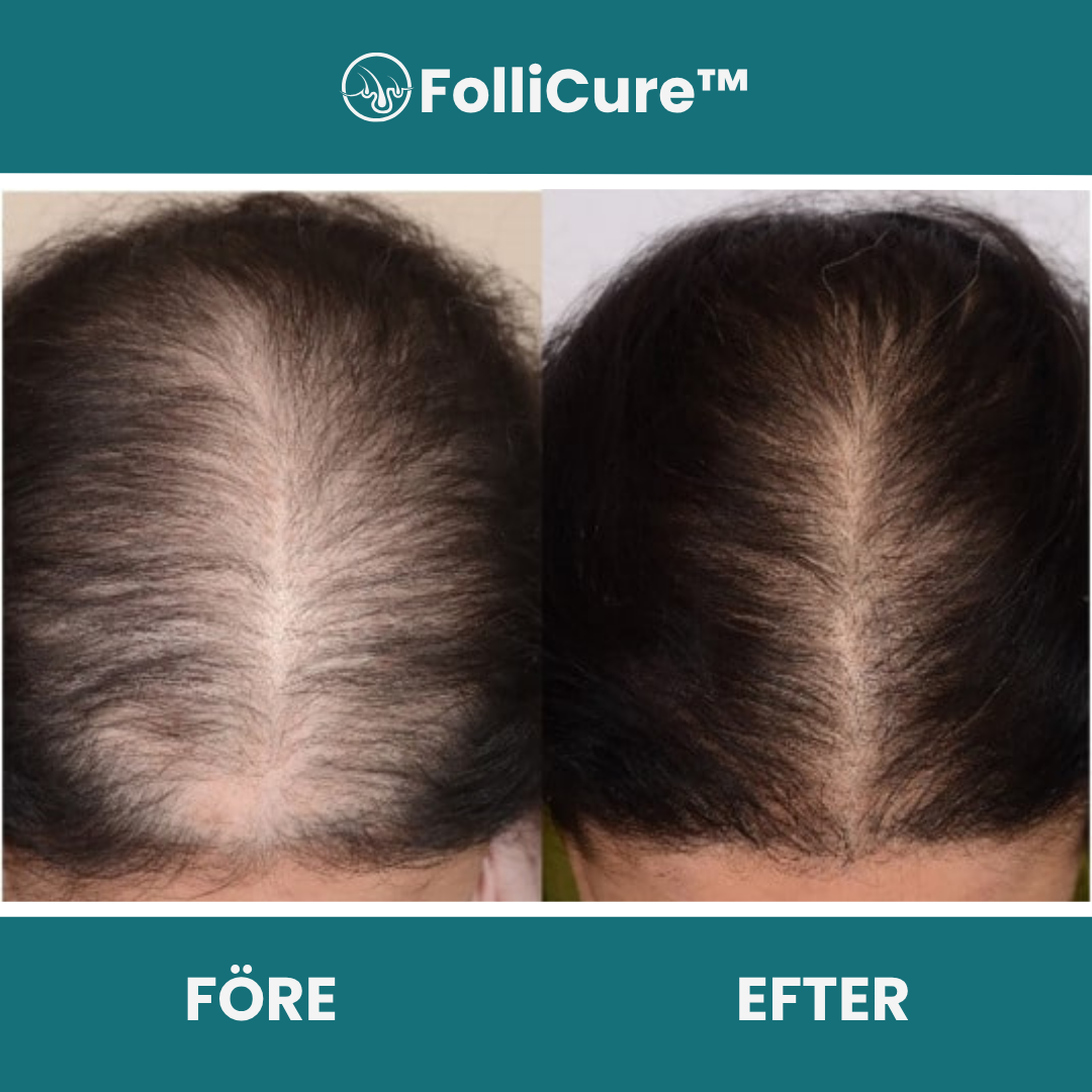 FolliCure™ Schampo Mot Håravfall