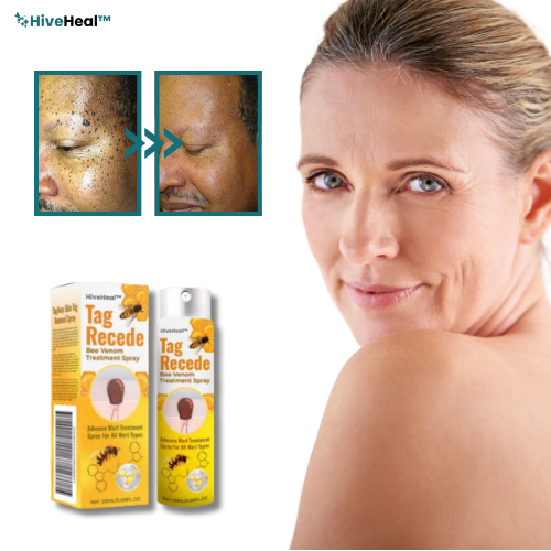 HiveHeal™ | Bivengift Hudfläcksspray