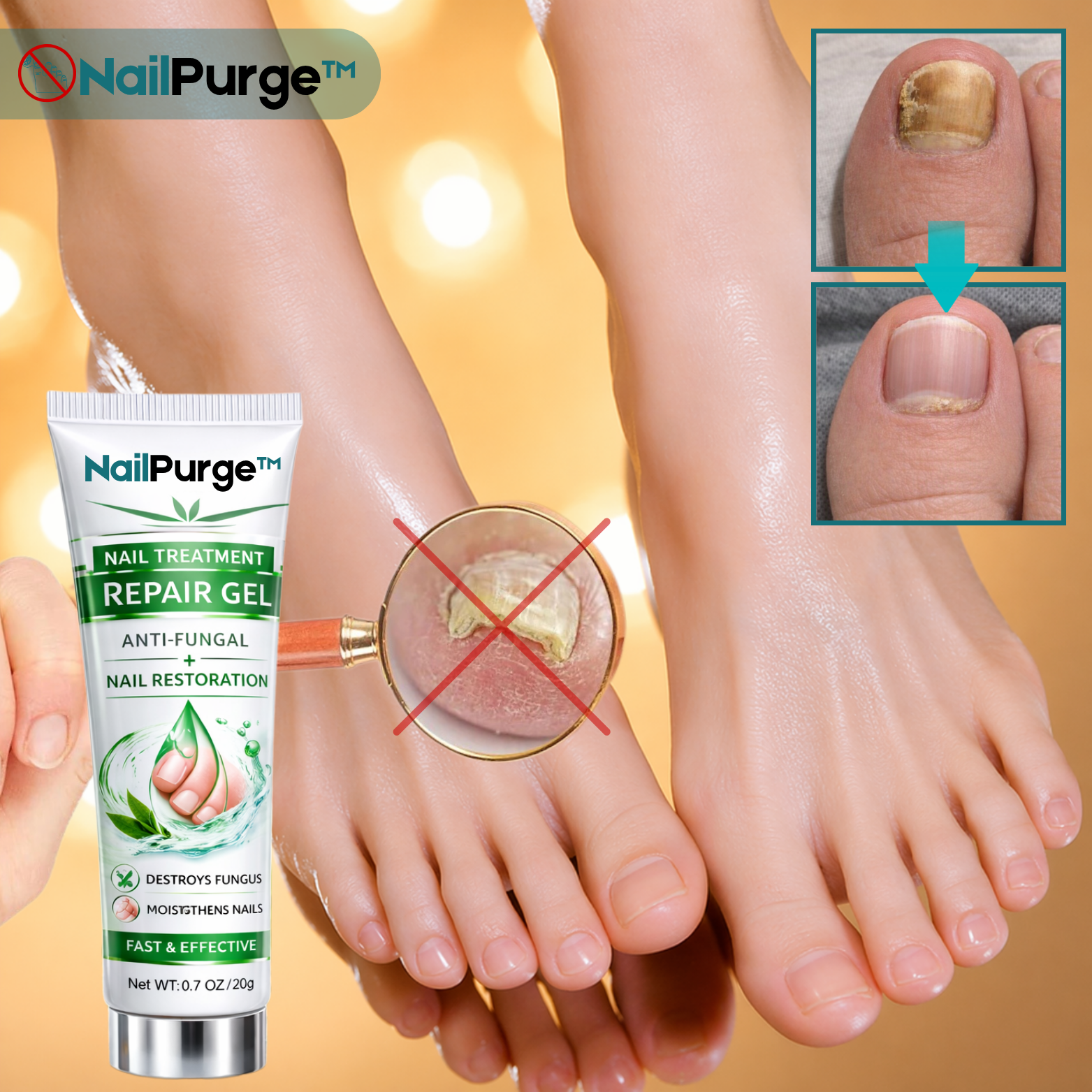 NailPurge™ Nagelbehandlings Reparationsgel