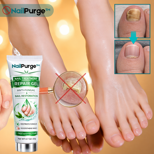 NailPurge™ Nagelbehandlings Reparationsgel