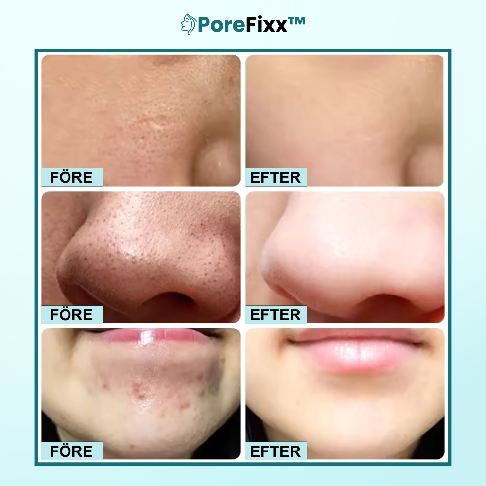 PoreFixx™ Resin Salva