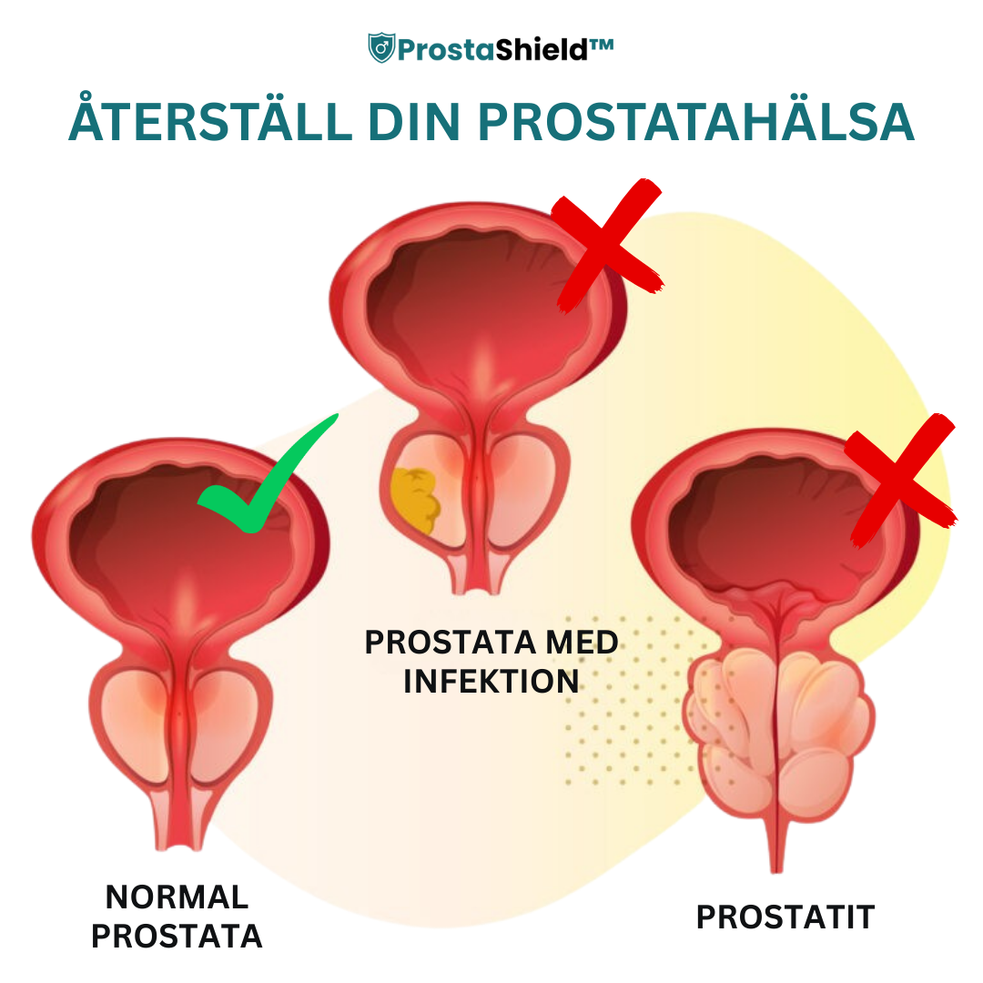 ProstaShield™ Prostatakapslar