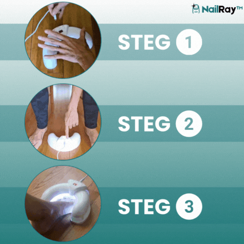 NailRay™ Laser Nagelbehandlingsenhet