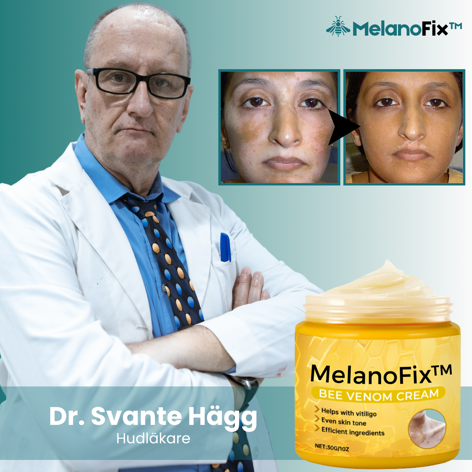 MelanoFix™ Upplysande & Återuppbyggande Kräm
