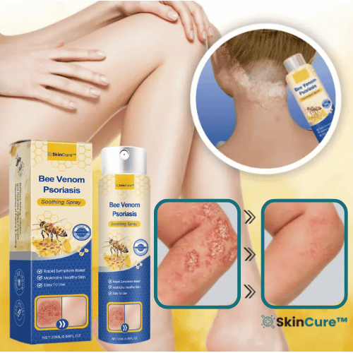 SkinCure™ Psoriasis Lugnande Spray