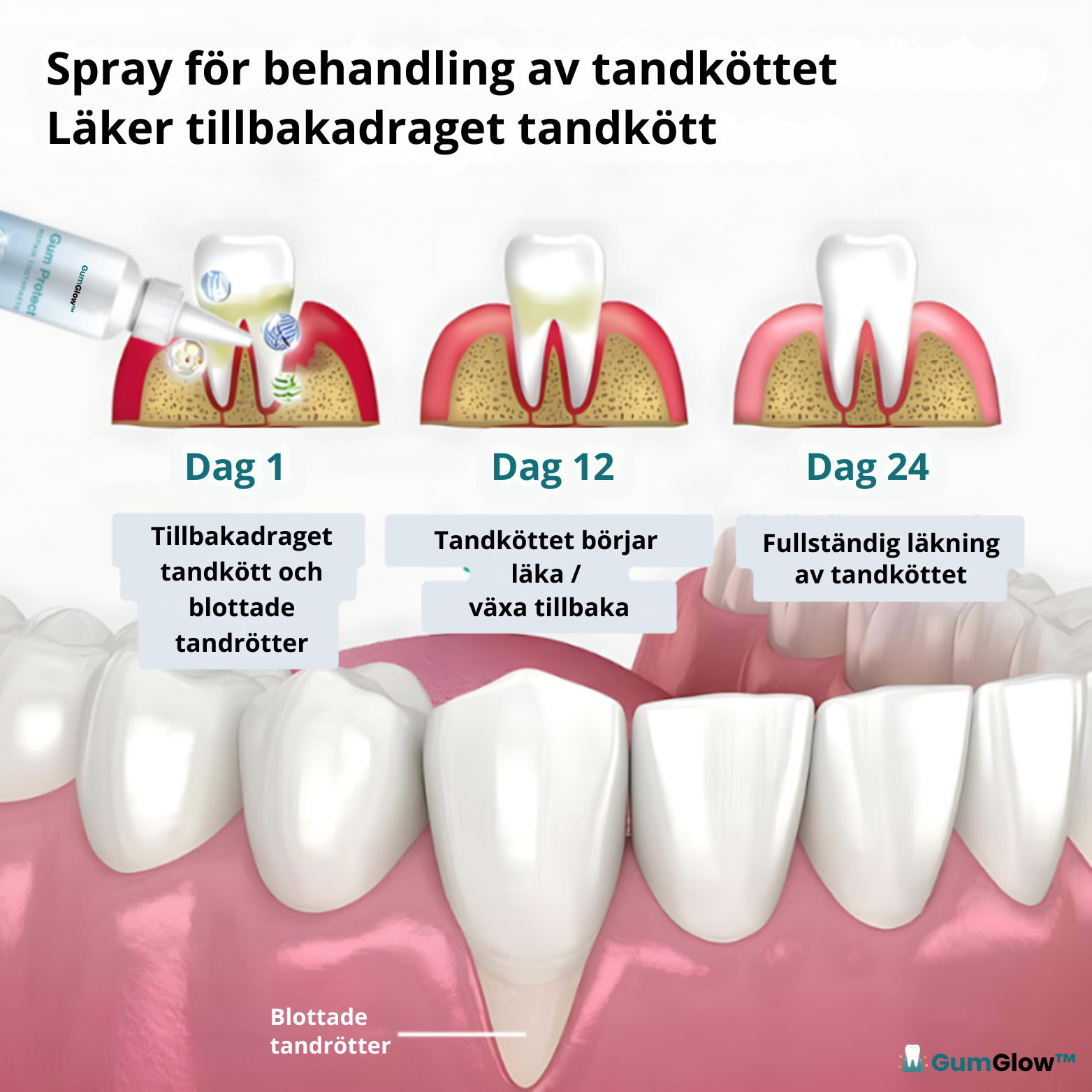 GumGlow™ Tandköttsspray