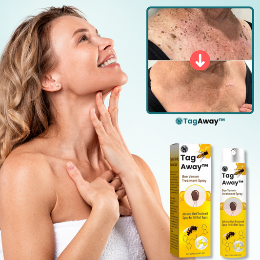 TagAway™ Behandlingsspray
