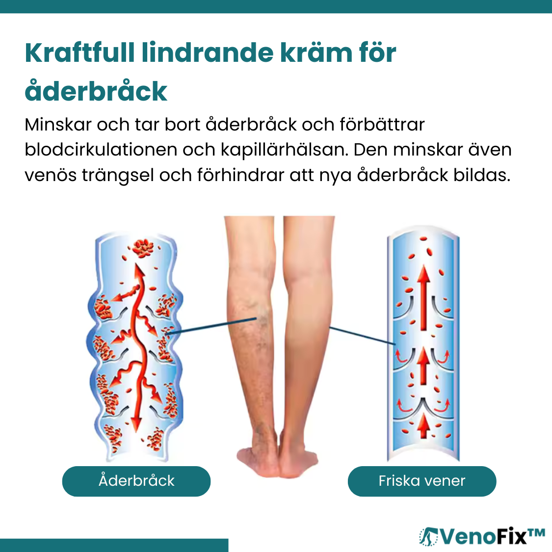 VenoFix™ Åderbråckskräm